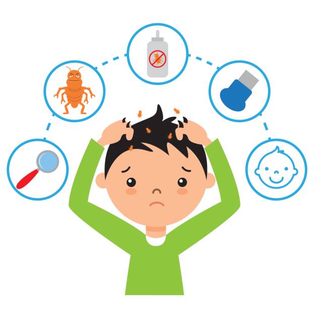Head Lice